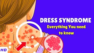 DRESS Syndrome – Causes Signs and Symptoms Diagnosis amp Treatment [upl. by Alben]