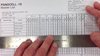 Blood Bank  Antibody Identification I [upl. by Aiyekal]