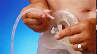 How to connect a urostomy pouch to night drainage bag [upl. by Bisset]