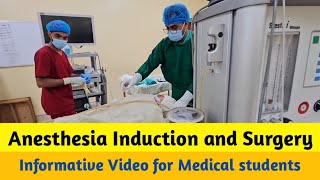 Anesthesia induction and Intubation  Surgery  Operation theater [upl. by Polad392]