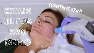 EXILIS ULTRA DEMONSTRATION FACE  Exilis Ultra 360 Experience at EuroPhoria [upl. by Oxley]