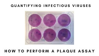 How to Perform a Plaque Assay [upl. by Yelad153]