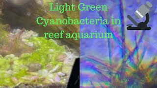 Light Green Reef Cyanobacteria under microscope  Blue Green Algae [upl. by Biggs403]