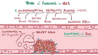 Hemolytic uremic syndrome [upl. by Nalek325]