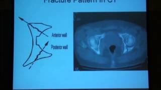 12 Radiological diagnosis of the acetabulum H Abdel Azeem [upl. by Enavi301]