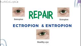 REPAIR ECTROPION amp ENTROPION CPT TOPICS MEDICAL CODING AND BILLING medicalcodercertified [upl. by Eloci231]