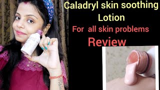 caladryl lotion reviewany skin allergiesone solutionin hindi [upl. by Alcinia]