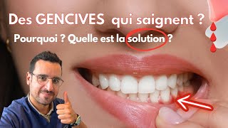 Explication GENCIVE qui SAIGNE  la solution [upl. by Penman883]