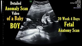 20 Week 4 Days Anomaly Scan in Pregnancy  Detailed Anatomy USG Scan of Baby Boy [upl. by Namsu488]