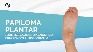 Papiloma plantar ¿Qué es causas diagnóstico prevención y tratamiento [upl. by Teuton787]