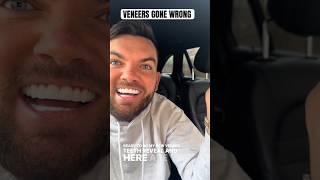 VENEERS GONE WRONG veneers [upl. by Sev]