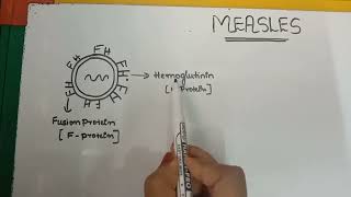 Measlescausesroute of spreaddiagnosepreventioncomplicationsTreatment [upl. by Zilla]