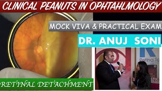 VIVA ON RETINAL DETACHMENT FOR DNB RESIDENTS IN OPHTHALMOLOGY PART 1 [upl. by Ardnuaek]