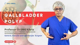 What is Gallbladder Polyp Causes Signs Symptoms and Treatment । Things You Need To Know [upl. by Hatokad]