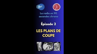 La radio en 90 sec chrono  Épisode 2  LES PLANS DE COUPE [upl. by Sandye]