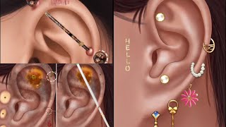 ASMR  Dirty ear treatment  earring hole cleaning  removing the pus from piercing [upl. by Westbrooke845]