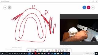 Limiting structures of maxillary arch Part 1 [upl. by Yrol]