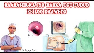 BAABSIIIRKA  hemorrhoids Dr faris [upl. by Nowujalo]