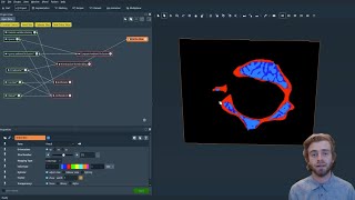 How to Perform Trabecular and Cortical Bone Segmentation [upl. by Avla]