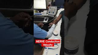 NERVE Conduction Velocity Test nerve conditioning velocity ot live music viral youtubeshorts [upl. by Esylla]