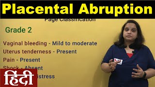 Antepartum Hemorrhage in Hindi  Placental Abruption Clinical Types Grading Signs  Nursing Lecture [upl. by Dupin]