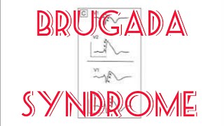 Brugada syndrome  Channelopathy including Short and long QT  Short qt [upl. by Odysseus]