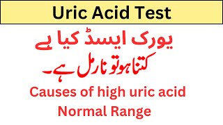 uric acid test uric acid kya hai causes of high uric acid [upl. by Darnell]