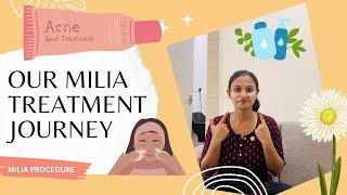 Milia Treatment 😒amp Essential Skincare🧴✨ GlowUp Journey🫶Adhila Noora💗 [upl. by Cele]