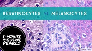 Melanocytes vs Keratinocytes Made Easy 5Minute Pathology Pearls [upl. by Alacim]