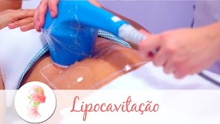 Lipocavitação tratamento estético reduz gordura localizada [upl. by Frayda]