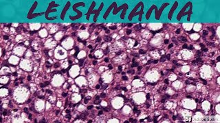 Leishmaniasis 5Minute Pathology Pearls [upl. by Amorete833]