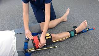 Traction Splint Application for use in Femur Fractures [upl. by Isak997]