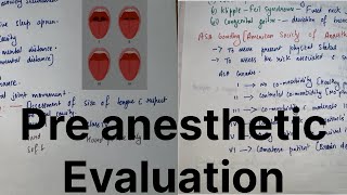 Preanesthetic Evaluation  Anesthesia dene ke Pehle kya kya checkup karte hAllrounderdoctorfalit [upl. by Strauss]