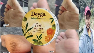 Deyga Foot Butter  Honest Review [upl. by Aiceila]