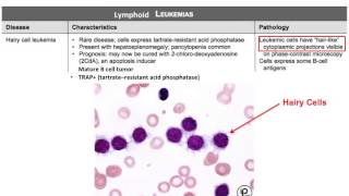 USMLE® Step 1 High Yield Oncology Leukemia [upl. by Atnoid]