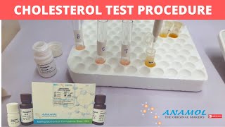 CHOLESTEROL Test Procedure  CHOLESTEROL Reagent  Procedure for performing CHOLESTEROL Reagent Test [upl. by Winnah984]