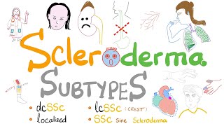 Scleroderma Subtypes 5 Types of Systemic Sclerosis incl Limited vs Diffuse Scleroderma [upl. by Carmen]