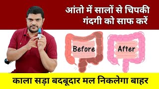 Homeopathic medicine for detox intestines constipation Homeopathic medicine [upl. by Euqinim]