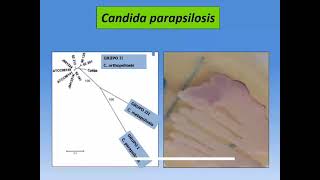 4 Seminario 10 Micosis Oportunistas 1 [upl. by Ecnarretal]