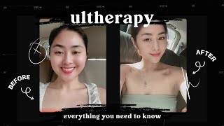 Smaller Face How To Celebrity Secret Tips  Ultherapy Before amp After Procedure  Stara Paredes 🤩 [upl. by Eelano]