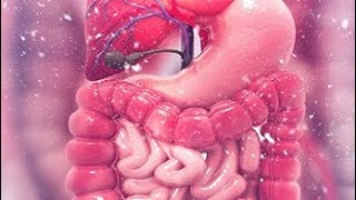 Intestinal obstruction part 2 and Benign tumor of intestine [upl. by Ibib]