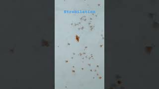 Jellyfish life cycle strobilation jellyfish sealife jellyfishfacts shortvideo short [upl. by Winchell]