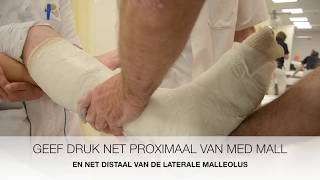 Repositie Enkel Luxatie Fractuur met gips 3 [upl. by Raoul]