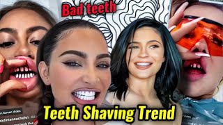 KYLIE JENNER amp KIM KARDASHIANS VENEERS GONE WRONG TURKEY TEETH WEIRD TREND [upl. by Fortunna]