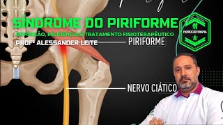 Síndrome do Piriforme  Definição Incidência e Tratamento Fisioterapêutico [upl. by Asaph]