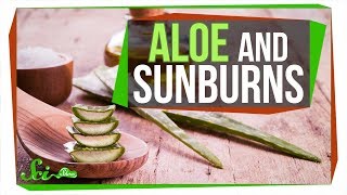 Does Aloe Really Treat a Sunburn [upl. by Aramaj75]