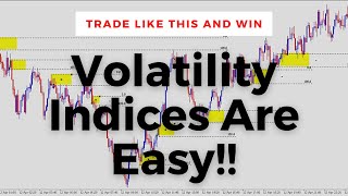 How To Trade Volatility Indices Institutional Trading Strategies [upl. by Rakabuba]