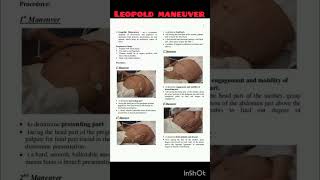 Leopold maneuver quick learning norcet nursingstudent shorts [upl. by Rasaec]