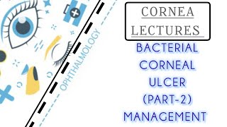 CORNEA LECTURE 4 MANAGEMENT OF BACTERIAL CORNEAL ULCER [upl. by Lekram]