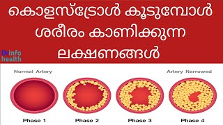 കോളസ്ട്രോൾ കൂടുമ്പോൾ ശരീരം കാണിക്കുന്ന ലക്ഷണങ്ങൾ Symptoms of high cholesterol in the bodymalayalam [upl. by Analim623]